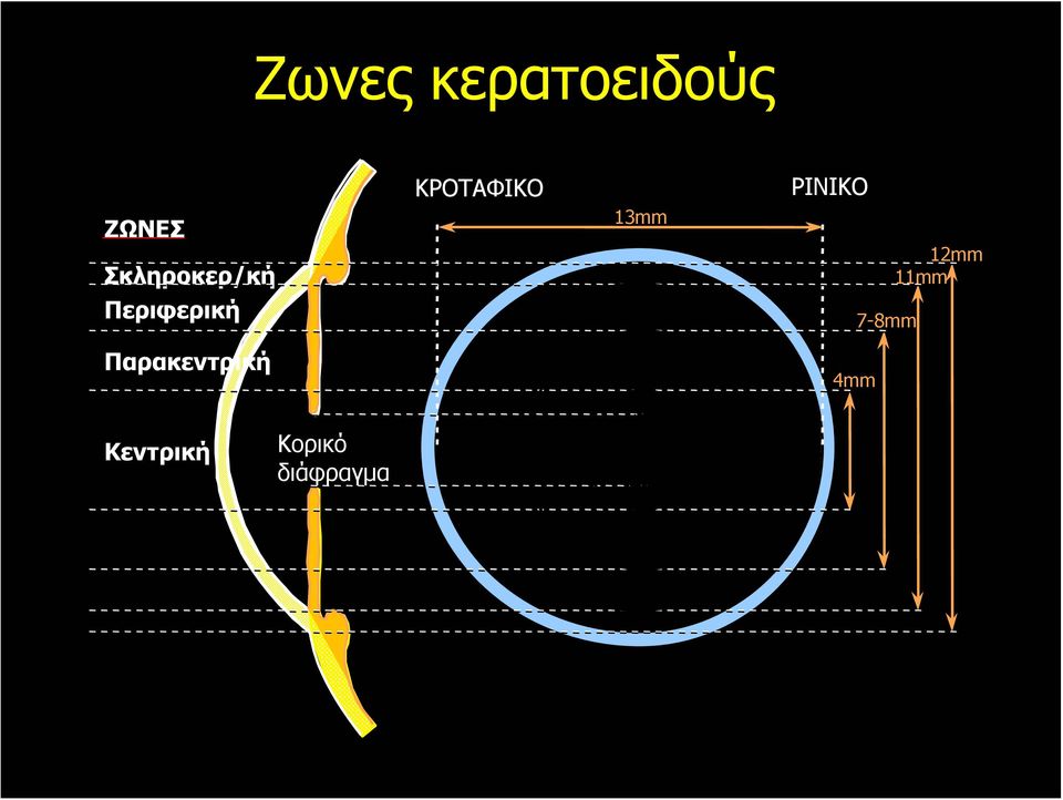 Παρακεντρική ΚΡΟΤΑΦΙΚΟ 13mm