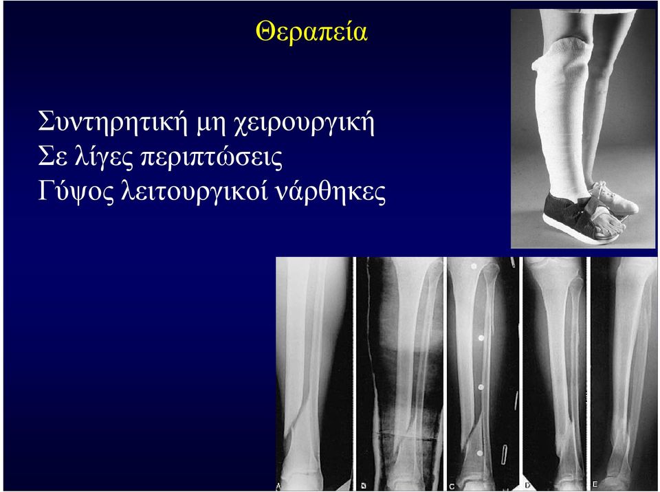 λίγες περιπτώσεις