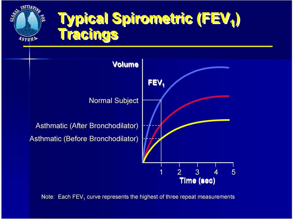 (Before Bronchodilator) 1 2 3 4 5 Time (sec) Note: Each