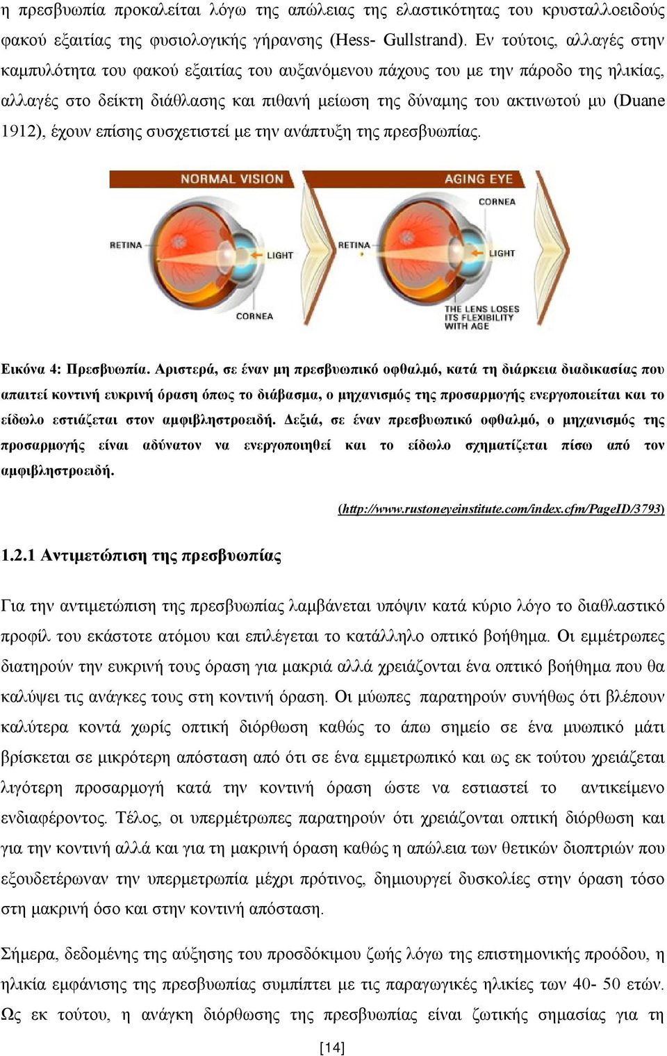 έχουν επίσης συσχετιστεί με την ανάπτυξη της πρεσβυωπίας. Εικόνα 4: Πρεσβυωπία.