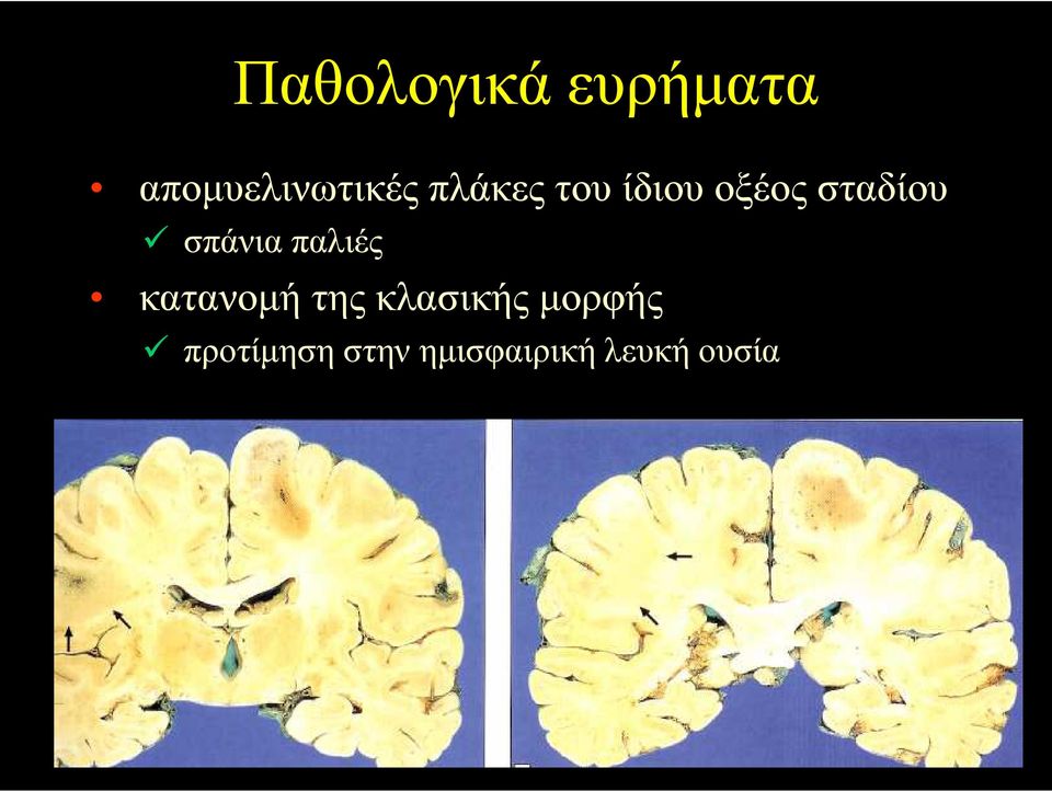 σπάνια παλιές κατανοµή της κλασικής