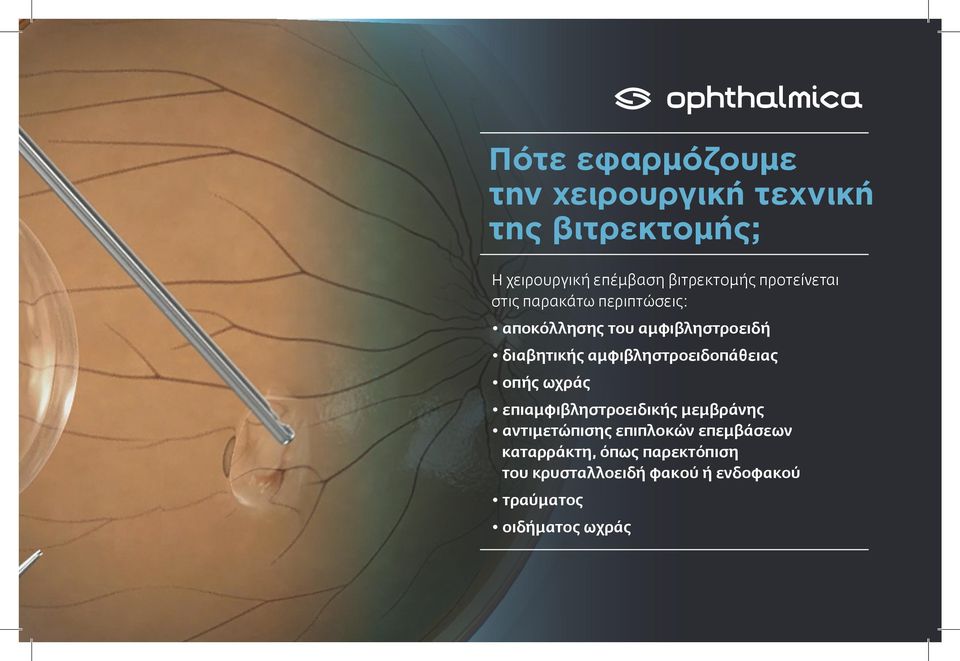 διαβητικής αμφιβληστροειδοπάθειας οπής ωχράς επιαμφιβληστροειδικής μεμβράνης αντιμετώπισης