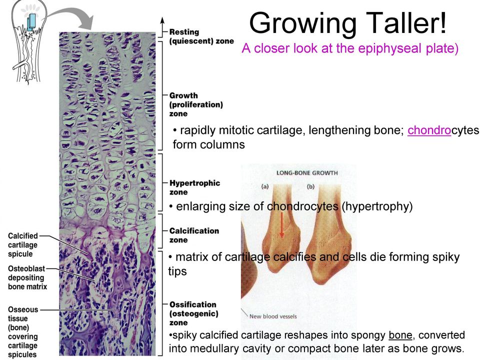chondrocytes (hypertrophy) matrix of cartilage calcifies and cells die forming spiky tips