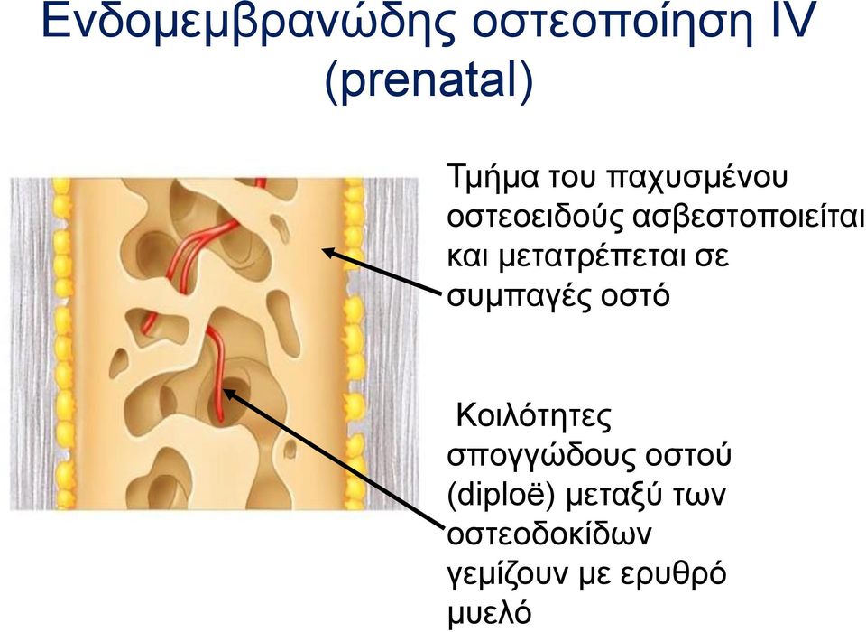 μετατρέπεται σε συμπαγές οστό Κοιλότητες σπογγώδους