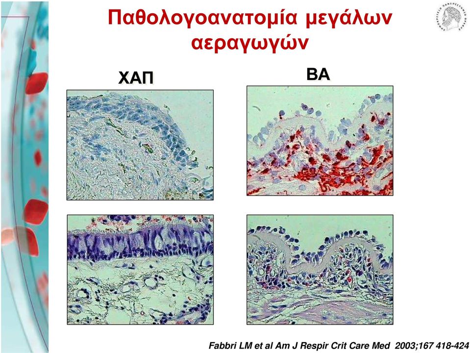 LM et al Am J Respir Crit