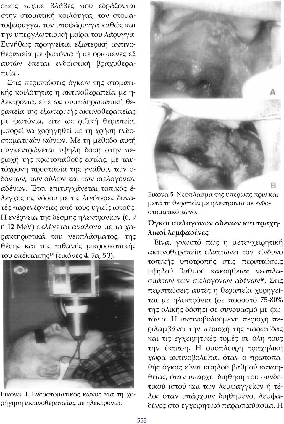 Στις περιπτώσεις όγκων της στοματικής κοιλότητας η ακτινοθεραπεία με η λεκτρόνια, είτε ως συμπληρωματική θεραπεία της εξωτερικής ακτινοθεραπείας με φωτόνια, είτε ως ριζική θεραπεία, μπορεί να