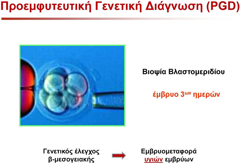 3 ων ημερών Γενετικός έλεγχος