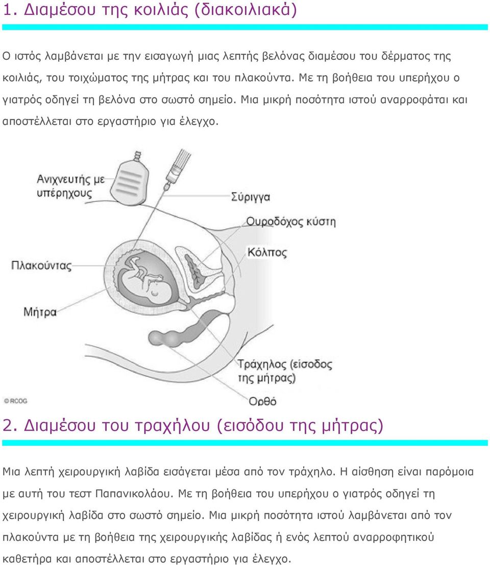 Διαμέσου του τραχήλου (εισόδου της μήτρας) Μια λεπτή χειρουργική λαβίδα εισάγεται μέσα από τον τράχηλο. Η αίσθηση είναι παρόμοια με αυτή του τεστ Παπανικολάου.