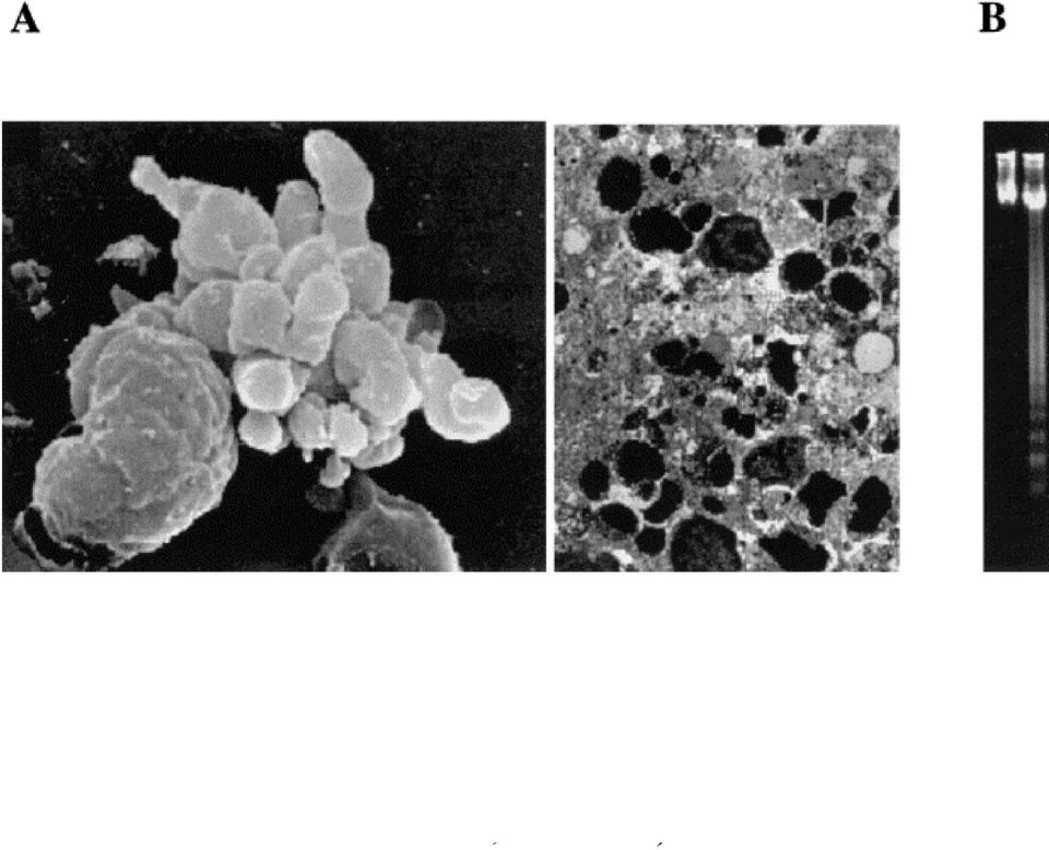 A: Blebbing (left) and nuclear condensation (right).
