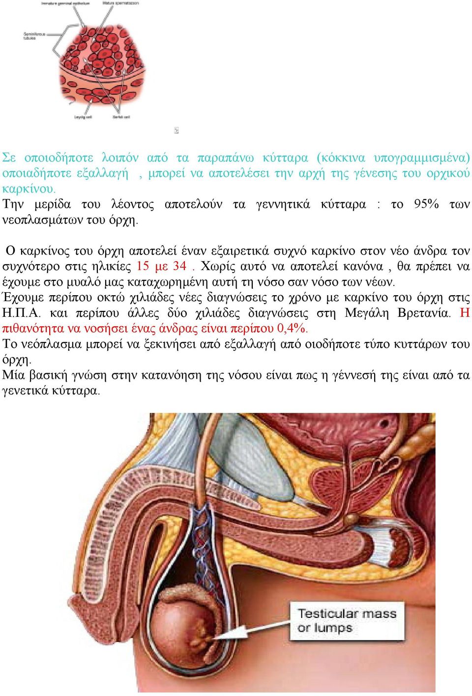 Χωρίς αυτό να αποτελεί κανόνα, θα πρέπει να έχουμε στο μυαλό μας καταχωρημένη αυτή τη νόσο σαν νόσο των νέων. Έχουμε περίπου οκτώ χιλιάδες νέες διαγνώσεις το χρόνο με καρκίνο του όρχη στις Η.Π.Α.