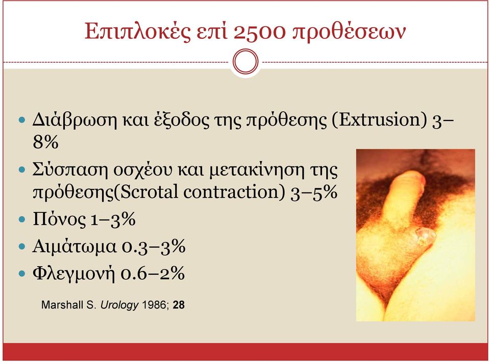 ηεο πξόζεζεο(scrotal contraction) 3 5% Πόλνο 1 3%