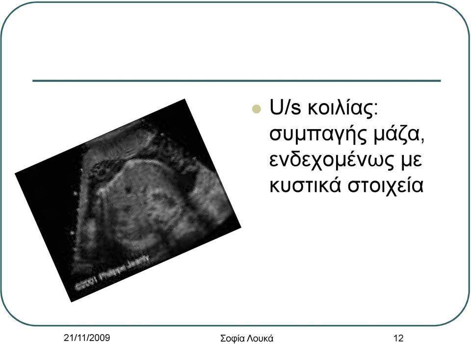 κυστικά στοιχεία