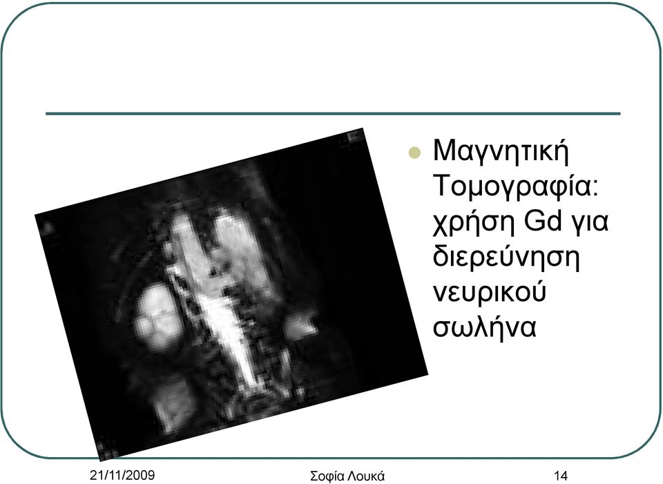 διερεύνηση νευρικού