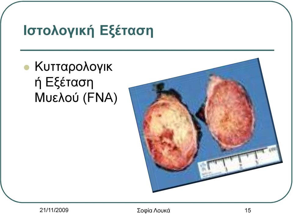 Εξέταση Μυελού