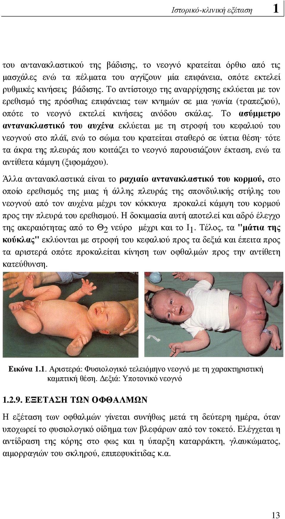 Το ασύµµετρο αντανακλαστικό του αυχένα εκλύεται µε τη στροφή του κεφαλιού του νεογνού στο πλάϊ, ενώ το σώµα του κρατείται σταθερό σε ύπτια θέση.