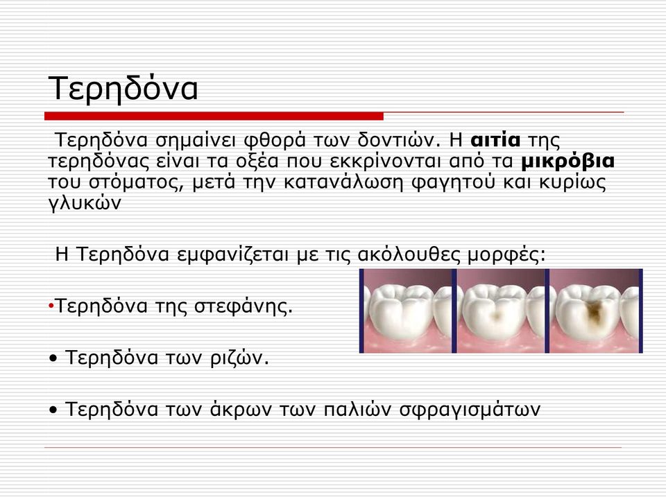 στόματος, μετά την κατανάλωση φαγητού και κυρίως γλυκών Η Τερηδόνα