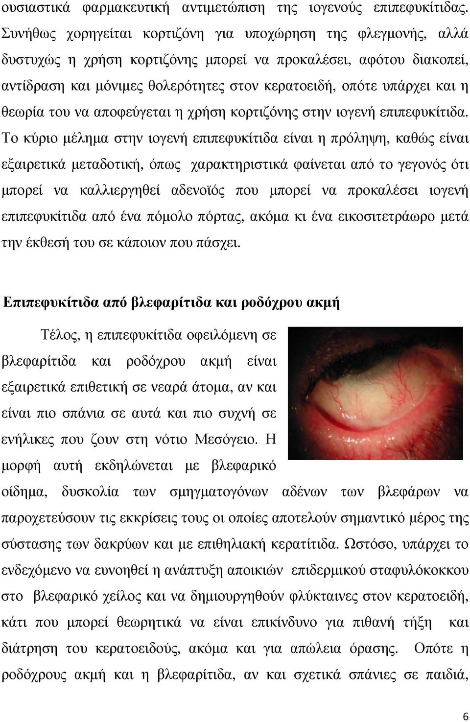 η θεωρία του να αποφεύγεται η χρήση κορτιζόνης στην ιογενή επιπεφυκίτιδα.