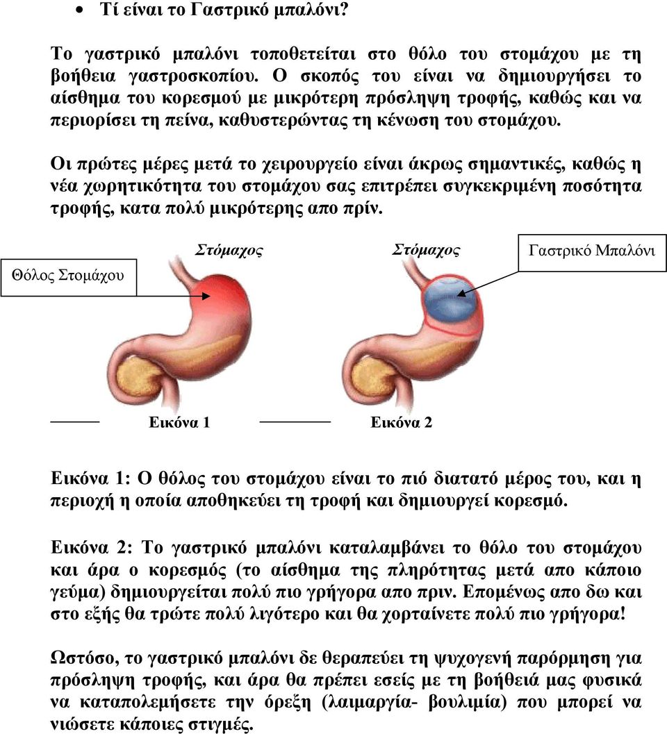 Οι πρώτες µέρες µετά το χειρουργείο είναι άκρως σηµαντικές, καθώς η νέα χωρητικότητα του στοµάχου σας επιτρέπει συγκεκριµένη ποσότητα τροφής, κατα πολύ µικρότερης απο πρίν.