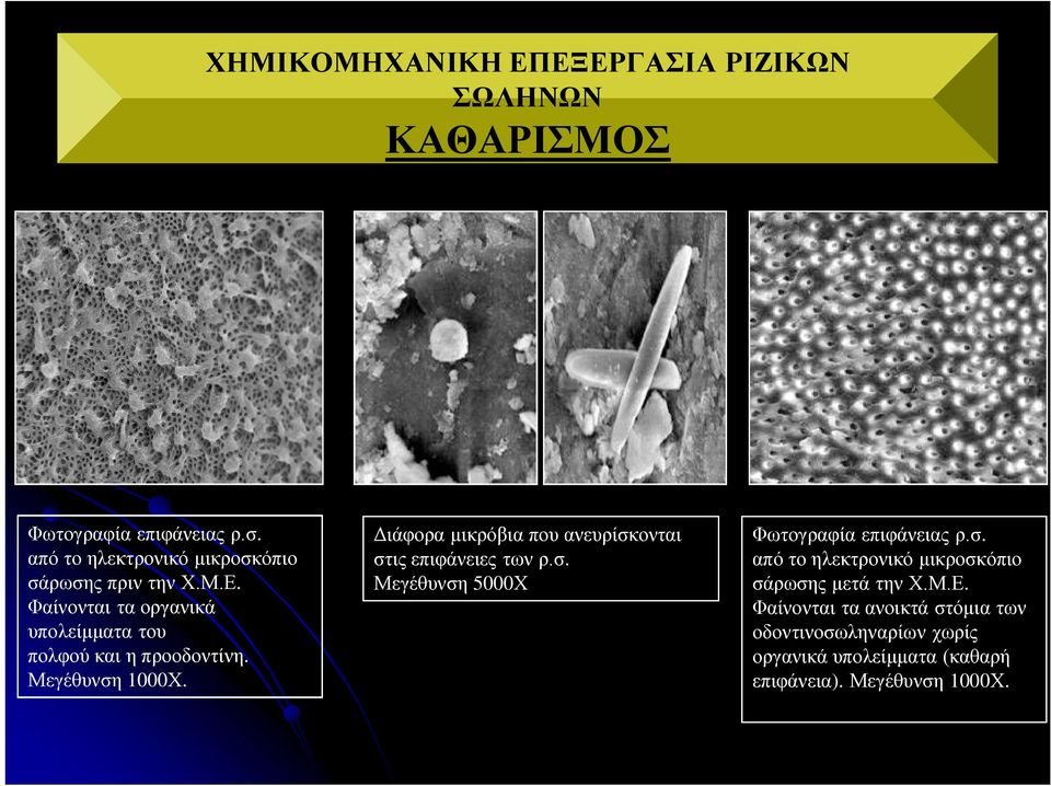 Μεγέθυνση 1000Χ. Διάφορα μικρόβια που ανευρίσκονται στις επιφάνειες των ρ.σ. Μεγέθυνση 5000Χ Φωτογραφία επιφάνειας ρ.σ. από το ηλεκτρονικό μικροσκόπιο σάρωσης μετά την Χ.