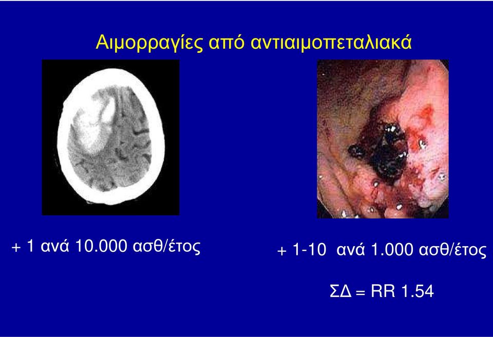 ανά 10.