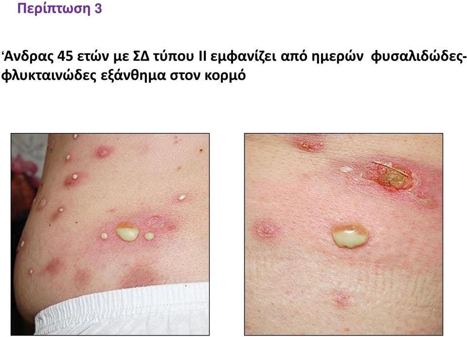από ημερών