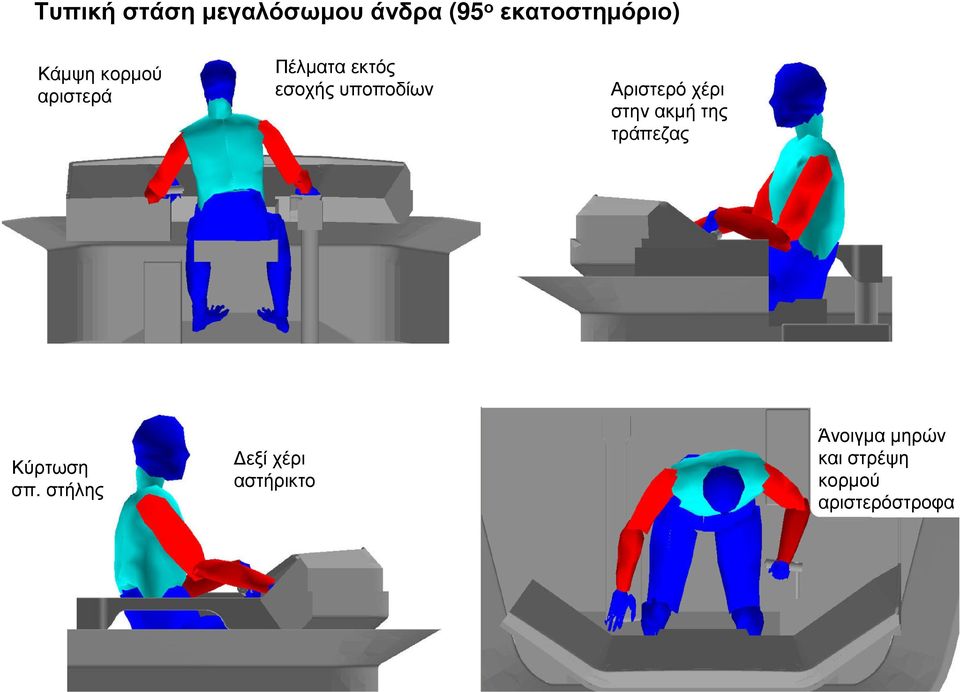 χέρι στην ακµή της τράπεζας Κύρτωση σπ.