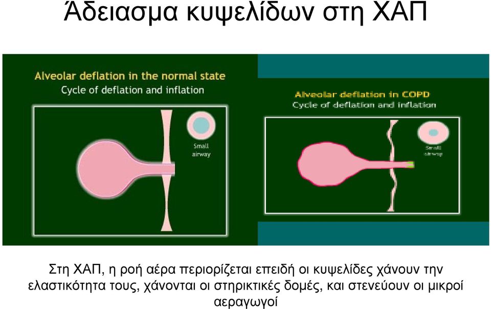 χάνουν την ελαστικότητα τους, χάνονται οι