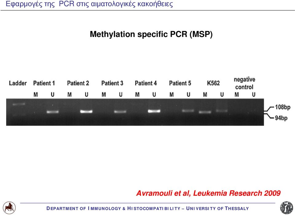 Methylation specific PCR