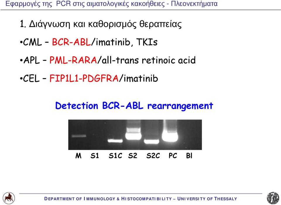 Διάγνωση και καθορισμός θεραπείας CML BCR-ABL/imatinib, TKIs