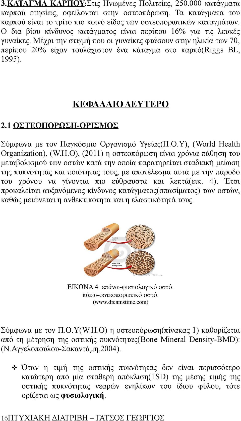 Μέχρι την στιγμή που οι γυναίκες φτάσουν στην ηλικία των 70, περίπου 20% είχαν τουλάχιστον ένα κάταγμα στο καρπό(riggs BL, 1995). 2.1 ΟΣΤΕΟΠΟΡΩΣΗ-ΟΡΙΣΜΟΣ ΚΕΦΑΛΑΙΟ ΔΕΥΤΕΡΟ Σύμφωνα με τον Παγκόσμιο Οργανισμό Υγείας(Π.