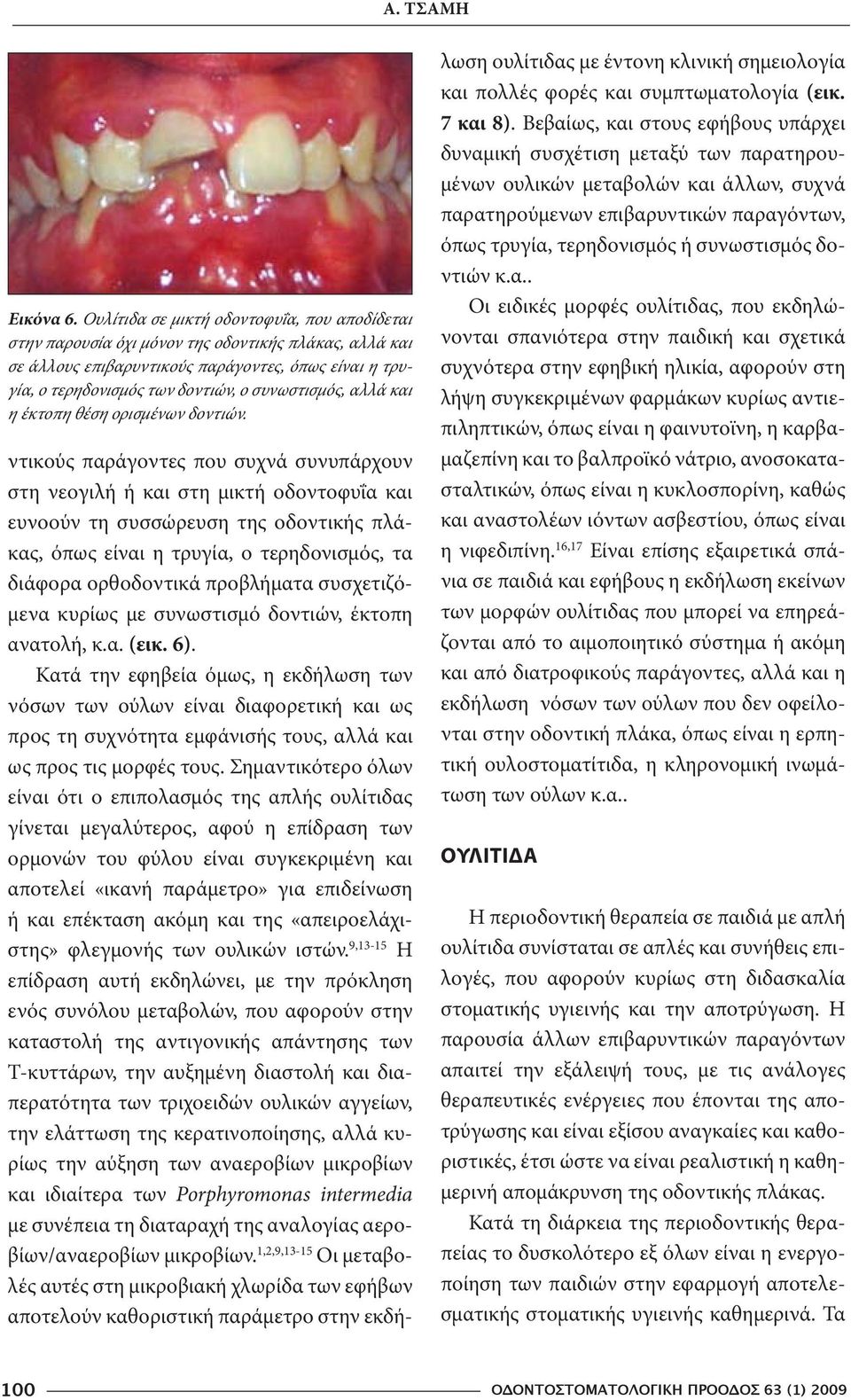 συνωστισμός, αλλά και η έκτοπη θέση ορισμένων δοντιών.