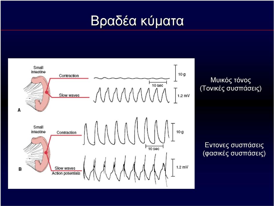 συσπάσεις) Εντονες