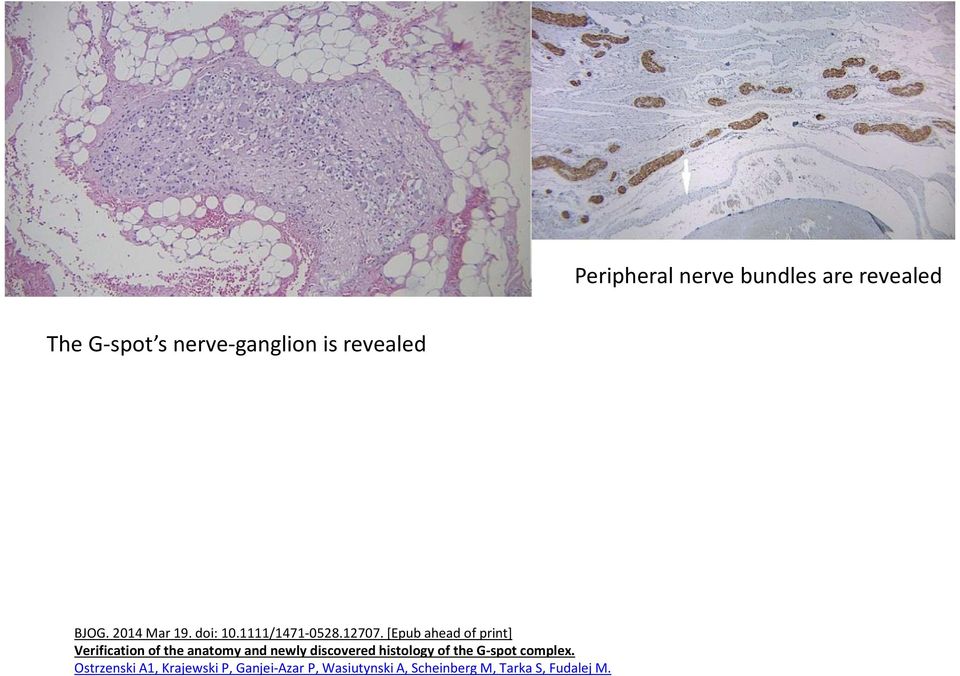 [Epub ahead of print] Verification of the anatomy and newly discovered histology