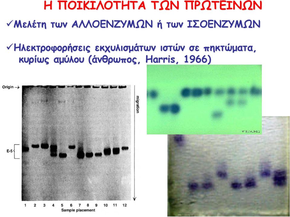 Ηλεκτροφορήσεις εκχυλισμάτων ιστών σε
