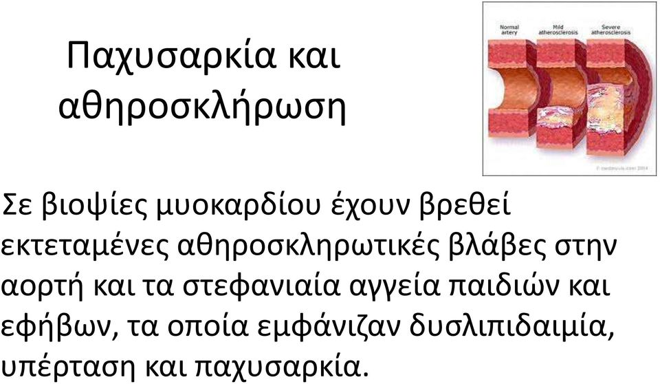 αορτι και τα ςτεφανιαία αγγεία παιδιϊν και εφιβων, τα