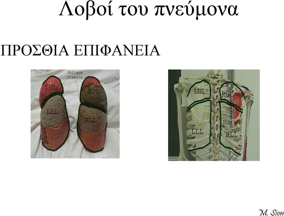 ΠΡΟΣΘΙΑ