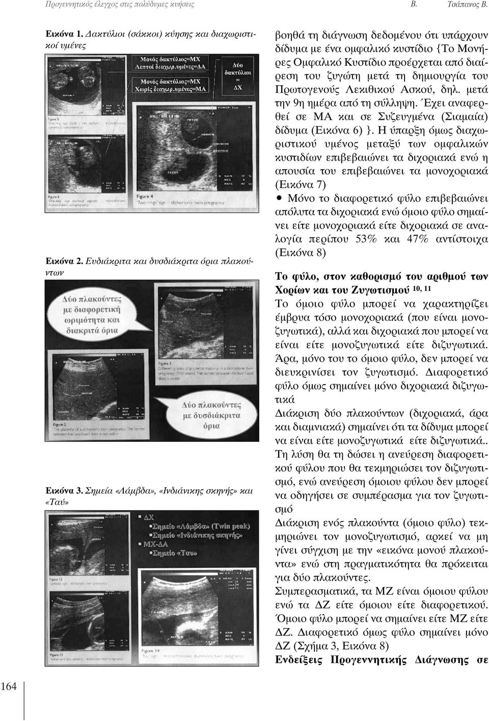 δημιουργία του Πρωτογενούς Λεκιθικού Ασκού, δηλ. μετά την 9η ημέρα από τη σύλληψη. Έχει αναφερθεί σε ΜΑ και σε Συζευγμένα (Σιαμαία) δίδυμα (Εικόνα 6) }.