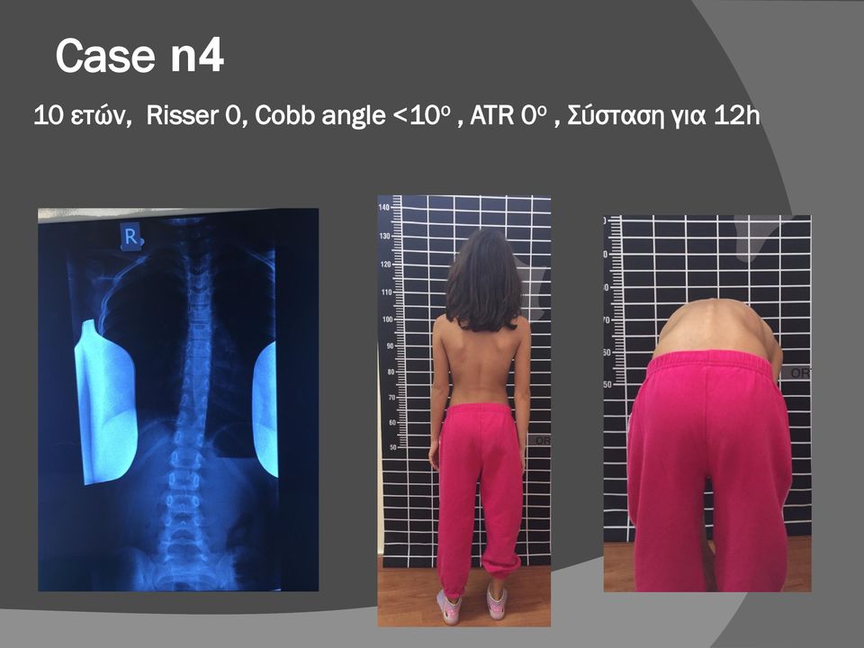 angle <10 ο, ATR
