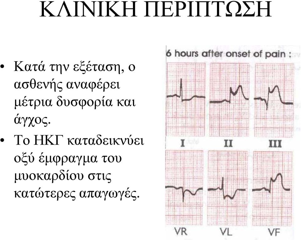 άγχος.