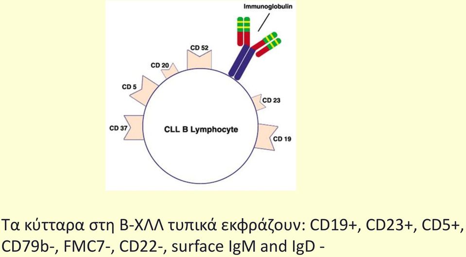 CD23+, CD5+, CD79b-,