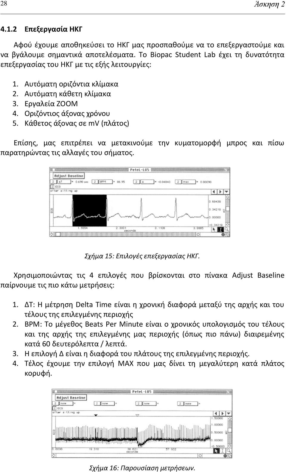 Κάκετοσ άξονασ ςε mv (πλάτοσ) Επίςθσ, μασ επιτρζπει να μετακινοφμε τθν κυματομορφι μπροσ και πίςω παρατθρϊντασ τισ αλλαγζσ του ςιματοσ. Σχήμα 15: Επιλογζσ επεξεργαςίασ ΗΚΓ.