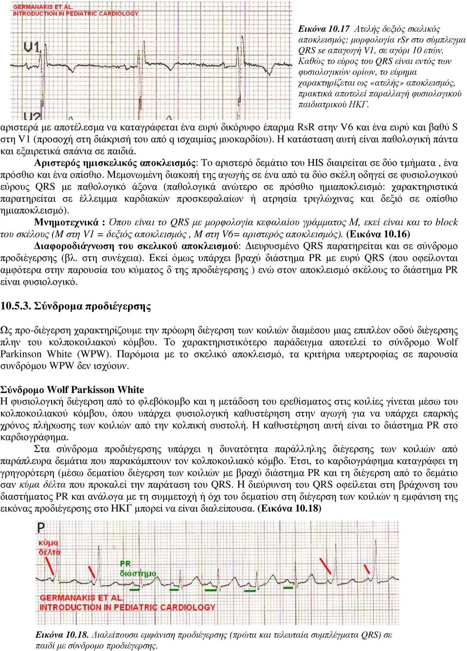 Μεµονωµένη διακοπή της αγωγής σε ένα από τα δύο σκέλη οδηγεί σε φυσιολογικού εύρους QRS µε παθολογικό άξονα (παθολογικά ανώτερο σε πρόσθιο ηµιαποκλεισµό: χαρακτηριστικά παρατηρείται σε έλλειµµα