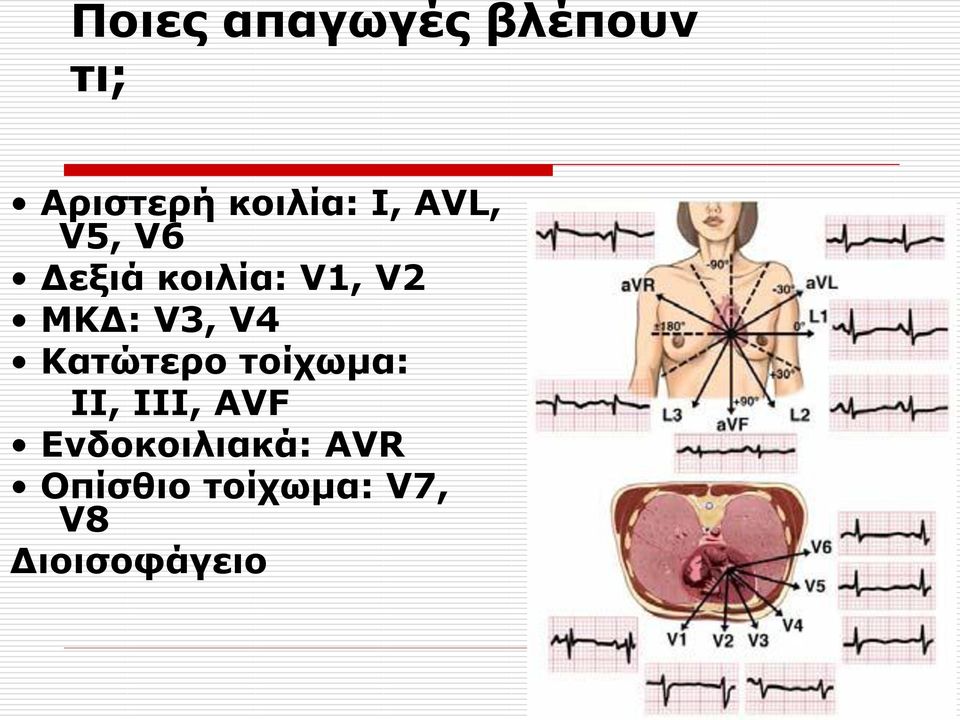 V4 Καηώηεπο ηοίσυμα: II, III, AVF