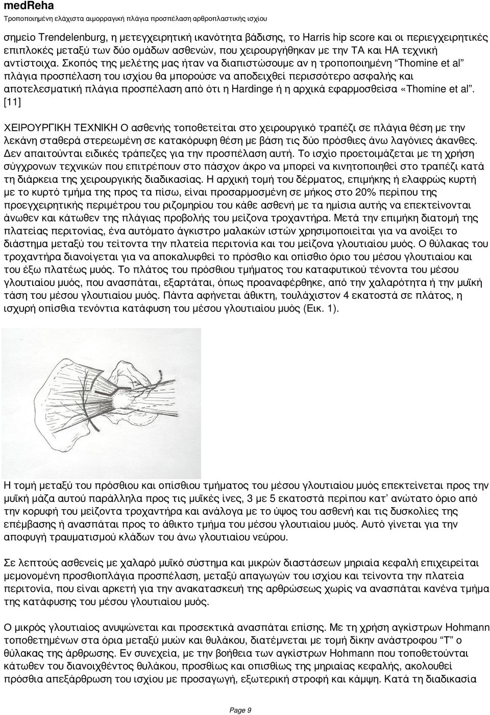 Hardinge ή η αρχικά εφαρμοσθείσα «Τhomine et al.