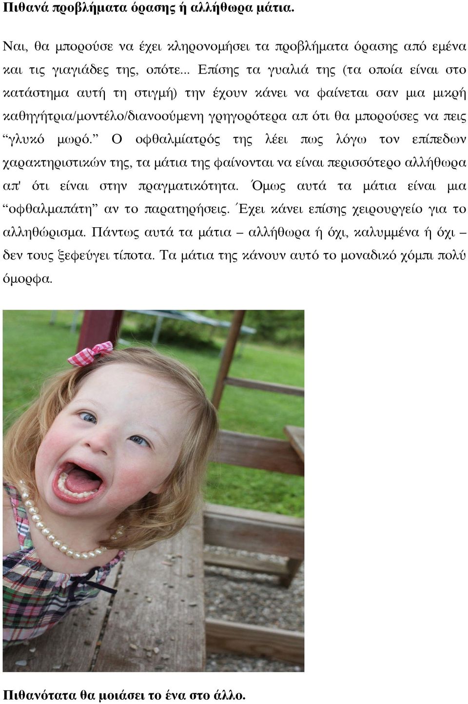 Ο οφθαλμίατρός της λέει πως λόγω τον επίπεδων χαρακτηριστικών της, τα μάτια της φαίνονται να είναι περισσότερο αλλήθωρα απ' ότι είναι στην πραγματικότητα.