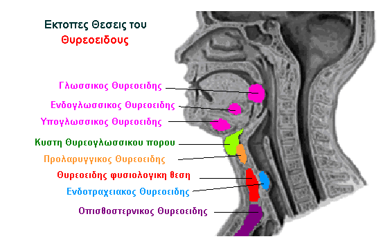 Οι έκτοπες θέσεις του θυρεοειδούς σχετίζονται µε ανωµαλίες κατά τη διάρκεια της διάπλασης του εµβρύου.