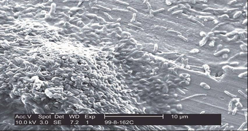 Εικόνα 2: Βιοφίλμ L. Pneumophila σε πόσιμο νερό. Πηγή : (Edelstein PH et.al, 2005) Μπορεί να επιβιώσει σε ευρύ φάσμα θερμοκρασιών (από 6-60 Κελσίου).