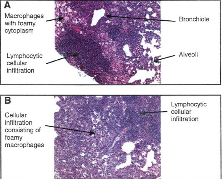 Abatacept θαη ΣΒ ( C57BL/6 mice )¹ Ο θίλδπλνο εκθάληζεο ή επαλελεξγνπνίεζεο ΣΒ άγλωζηνο. πνξαδηθέο πεξηπηώζεηο έρνπλ αλαθεξζεί.