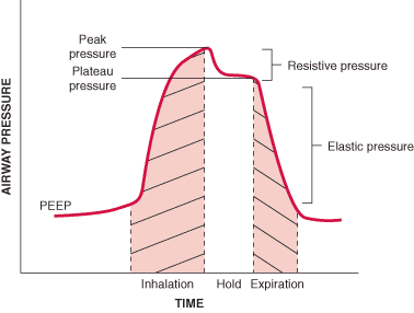 Μηχανικός αερισμός ΠΑΡΑΜΕΤΡΟΙ 1. Tidal Volume (Vt) 2. Πίεση Αεραγωγών (Paw) 3. Πίεση plateau (Pplat) 4. Συχνότητα (RR, f) 5.