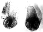 Βιολογικός κύκλος Ustilago (Γυμνού Άνθρακα) (1) Μολυσμένος (αριστερά) και